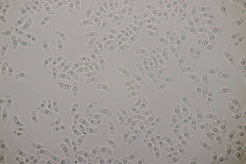 Crystal Brain Fungus