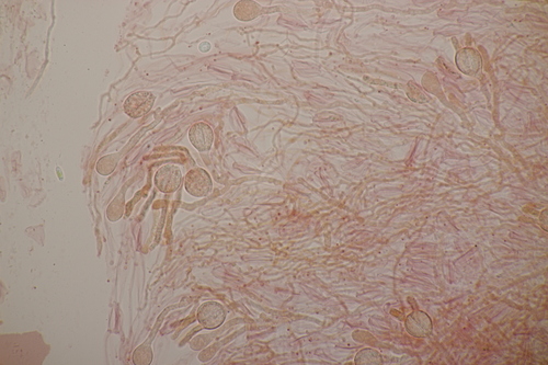 Crystal Brain Fungus